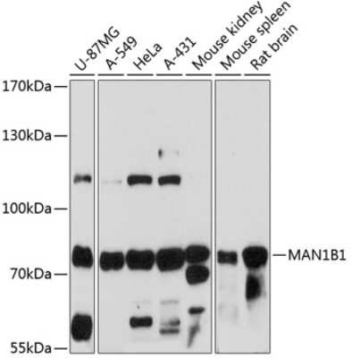 Western Blot: ERManI AntibodyAzide and BSA Free [NBP3-03426]