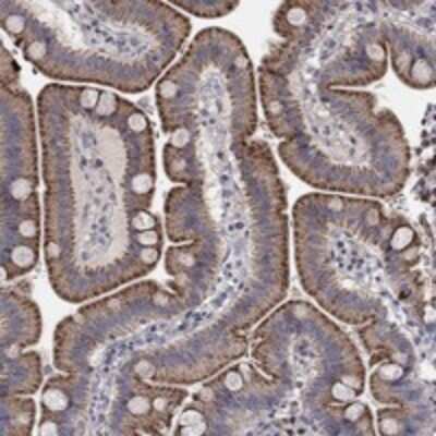 Immunohistochemistry-Paraffin: ERN2 Antibody [NBP3-17487]