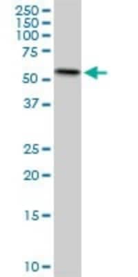 Western Blot: ERO1L Antibody (4G3) [H00030001-M01]