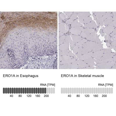 Immunohistochemistry-Paraffin: ERO1L Antibody [NBP1-84799]