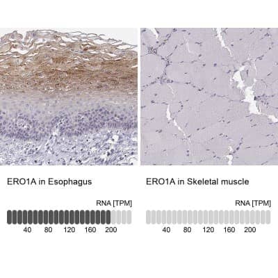 Immunohistochemistry-Paraffin: ERO1L Antibody [NBP1-84800]