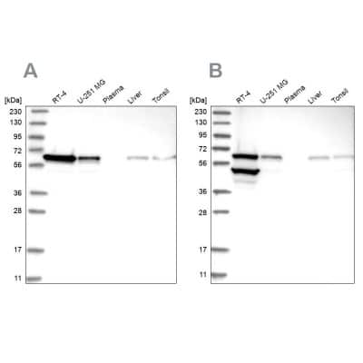 Western Blot: ERO1L Antibody [NBP1-84799]