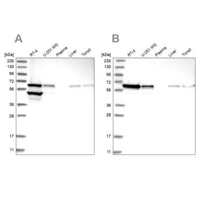 Western Blot: ERO1L Antibody [NBP1-84800]