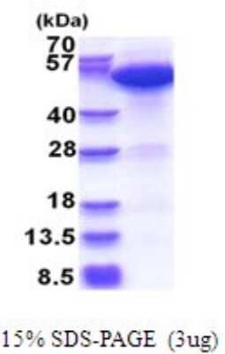 SDS-PAGE: Recombinant Human ERO1L His Protein [NBP2-51682]