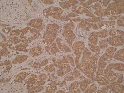 Immunohistochemistry: ERO1LB Antibody (M37-P5D11) - BSA Free [NBP2-50389]