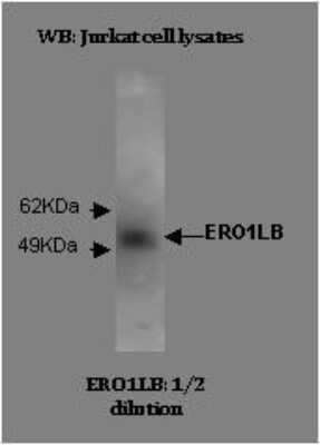 Western Blot: ERO1LB Antibody (M37-P5D11)BSA Free [NBP2-50389]