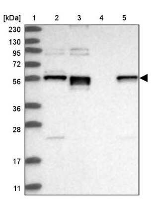 Western Blot: ERO1LB Antibody [NBP1-83961]