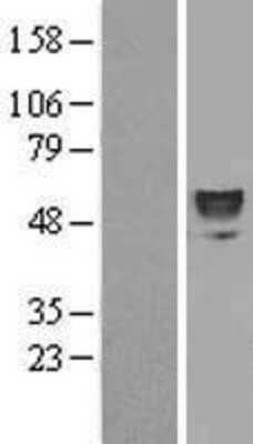 Western Blot: ERO1LB Overexpression Lysate [NBL1-10336]