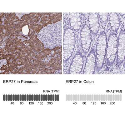 Immunohistochemistry-Paraffin: ERP27 Antibody [NBP1-88393]
