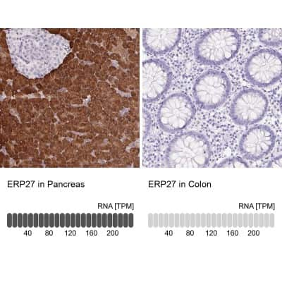 Immunohistochemistry-Paraffin: ERP27 Antibody [NBP2-38679]