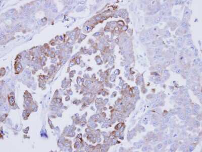 Immunohistochemistry-Paraffin: ERP29 Antibody [NBP1-33076]