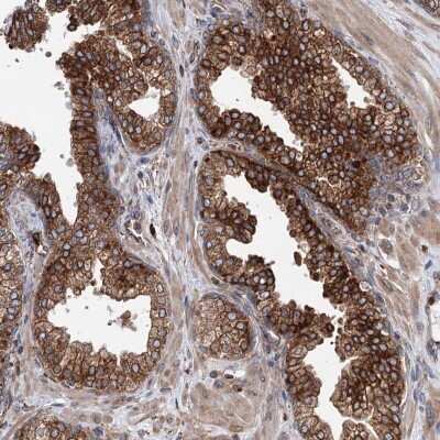 Immunohistochemistry-Paraffin: ERP29 Antibody [NBP1-88395]
