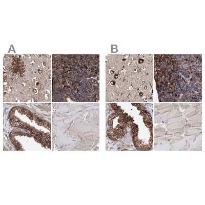 Immunohistochemistry-Paraffin: ERP29 Antibody [NBP1-88395]