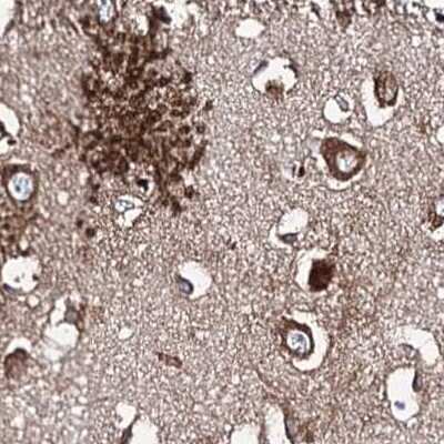 Immunohistochemistry-Paraffin: ERP29 Antibody [NBP1-88395]