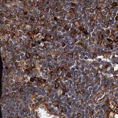Immunohistochemistry-Paraffin: ERP29 Antibody [NBP1-88395]