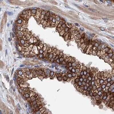 Immunohistochemistry-Paraffin: ERP29 Antibody [NBP1-88395]