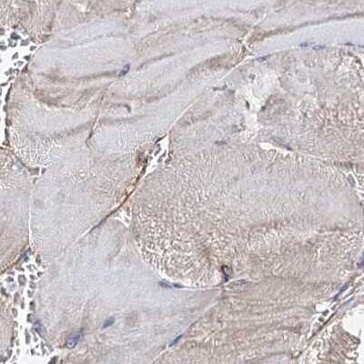 Immunohistochemistry-Paraffin: ERP29 Antibody [NBP1-88395]