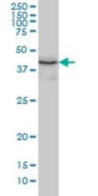 Western Blot: ERP44 Antibody (3C7) [H00023071-M01]