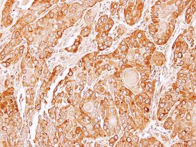 Immunohistochemistry-Paraffin: ERP44 Antibody [NBP1-32495]
