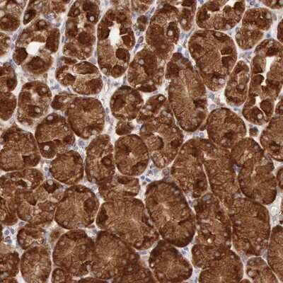 Immunohistochemistry-Paraffin: ERP44 Antibody [NBP1-89617]