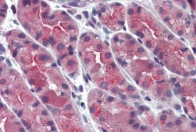 Immunohistochemistry-Paraffin: ERP44 Antibody [NBP3-14317]