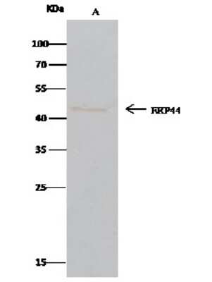Immunoprecipitation: ERP44 Antibody [NBP2-97000]