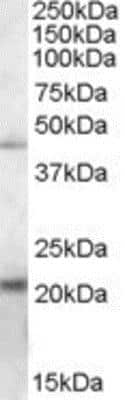 Western Blot: ERP44 Antibody [NB100-93457]