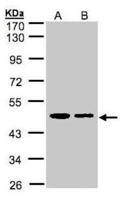 Western Blot: ERP44 Antibody [NBP1-32495]