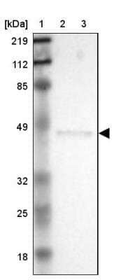 Western Blot: ERP44 Antibody [NBP1-89617]