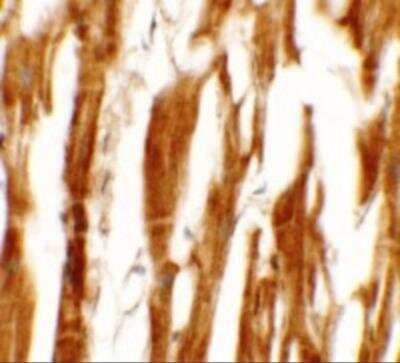 Immunohistochemistry: ERR beta/NR3B2 Antibody - BSA Free [NBP2-81824]