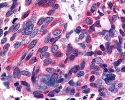 Immunohistochemistry-Paraffin: ERR beta/NR3B2 Antibody - BSA Free [NLS7131]