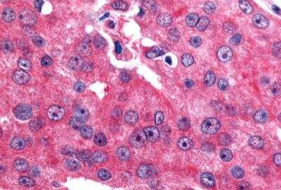 Immunohistochemistry-Paraffin: ERR beta/NR3B2 Antibody - BSA Free [NLS7131]
