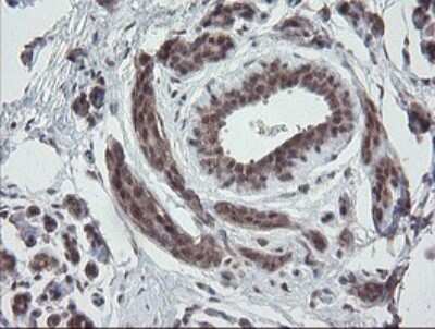 Immunohistochemistry: ERR gamma/NR3B3 Antibody (OTI1E5) [NBP2-45698]