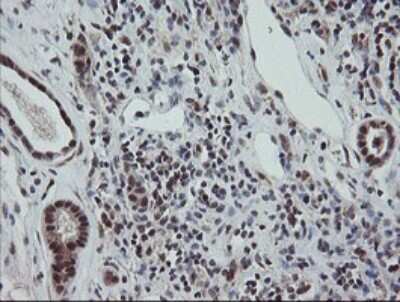 Immunohistochemistry: ERR gamma/NR3B3 Antibody (OTI1E5) [NBP2-45698]