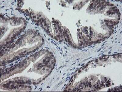 Immunohistochemistry: ERR gamma/NR3B3 Antibody (OTI1E5) [NBP2-45698]