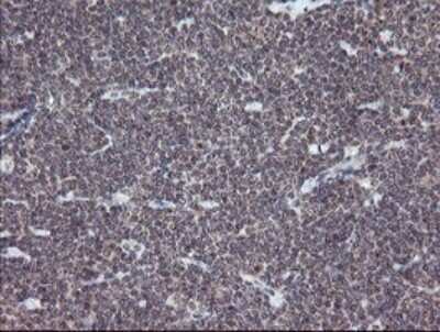 Immunohistochemistry: ERR gamma/NR3B3 Antibody (OTI1E5) [NBP2-45698]