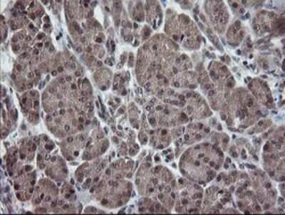 Immunohistochemistry: ERR gamma/NR3B3 Antibody (OTI1E5) [NBP2-45698]