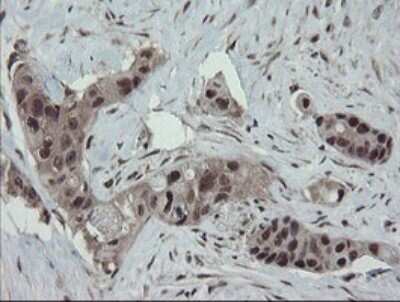 Immunohistochemistry: ERR gamma/NR3B3 Antibody (OTI1E5) [NBP2-45698]
