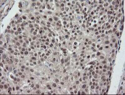Immunohistochemistry: ERR gamma/NR3B3 Antibody (OTI1E5) [NBP2-45698]