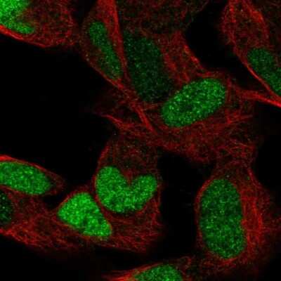 Immunocytochemistry/ Immunofluorescence: ERR gamma/NR3B3 Antibody [NBP1-91873]