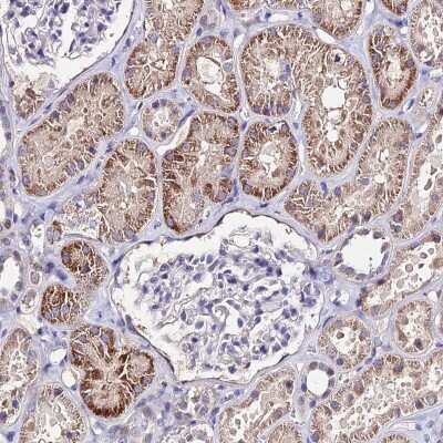 Immunohistochemistry-Paraffin: ERR gamma/NR3B3 Antibody [NBP1-91873]