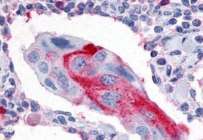 Immunohistochemistry-Paraffin: ERR gamma/NR3B3 Antibody - BSA Free [NLS5960]