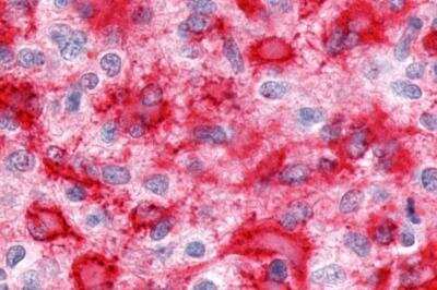 Immunohistochemistry-Paraffin: ERR gamma/NR3B3 Antibody - BSA Free [NLS5960]