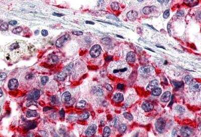 Immunohistochemistry-Paraffin: ERR gamma/NR3B3 Antibody - BSA Free [NLS5960]