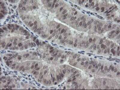Immunohistochemistry: ERR gamma/NR3B3 Antibody (OTI1E5) - Azide and BSA Free [NBP2-70691]