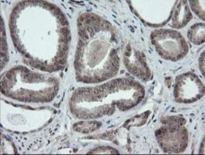 Immunohistochemistry: ERR gamma/NR3B3 Antibody (OTI1E5) - Azide and BSA Free [NBP2-70691]