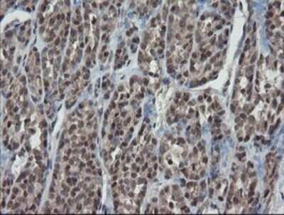 Immunohistochemistry: ERR gamma/NR3B3 Antibody (OTI1E5) - Azide and BSA Free [NBP2-70691]
