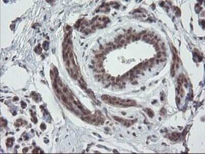 Immunohistochemistry: ERR gamma/NR3B3 Antibody (OTI1E5) - Azide and BSA Free [NBP2-70691]