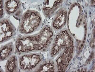 Immunohistochemistry: ERR gamma/NR3B3 Antibody (OTI1E5) - Azide and BSA Free [NBP2-70691]