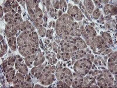 Immunohistochemistry: ERR gamma/NR3B3 Antibody (OTI1E5) - Azide and BSA Free [NBP2-70691]